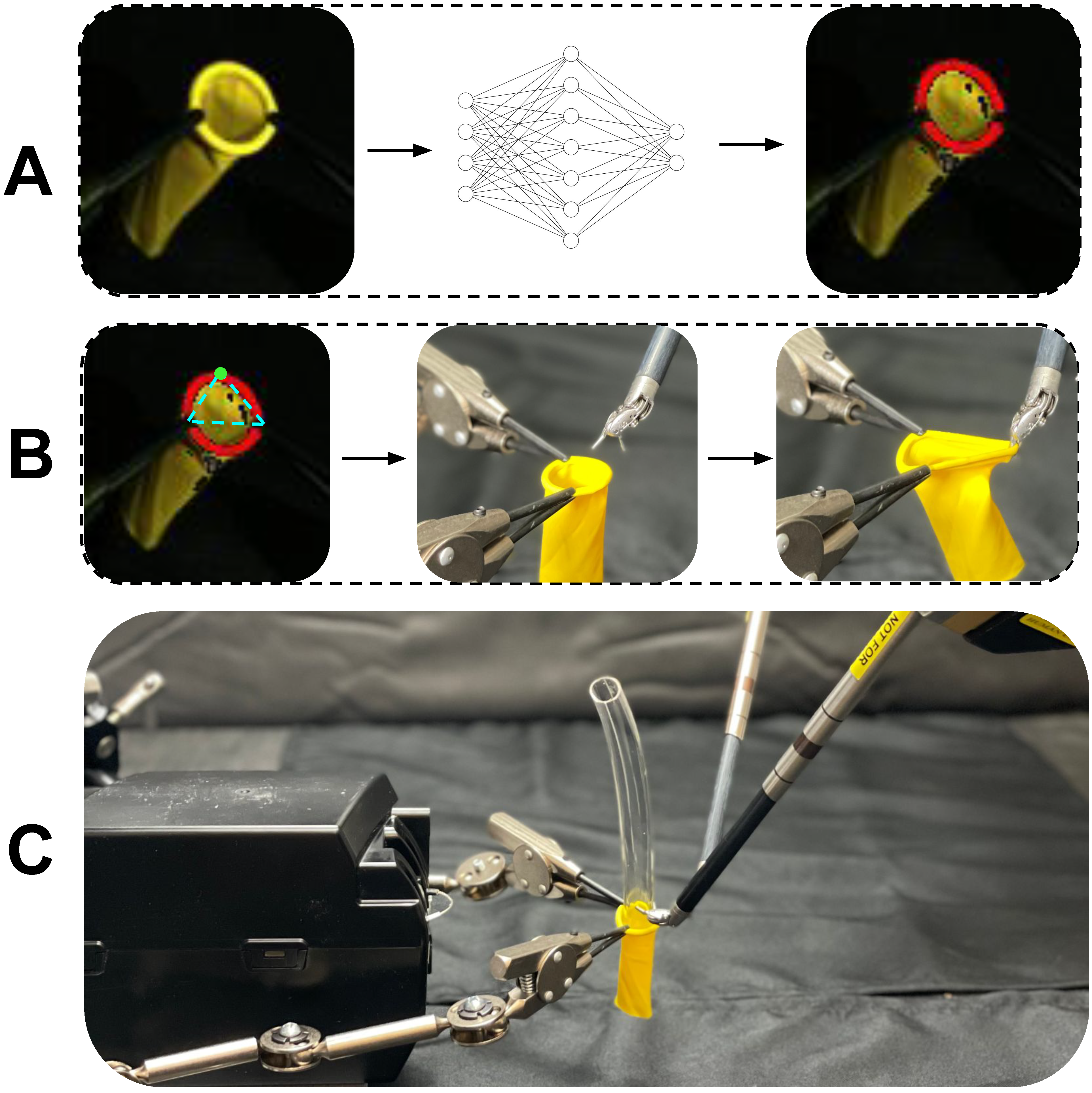 Automating Vascular Shunt Insertion thumbnail