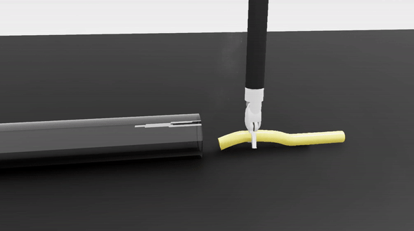 ORBIT-Surgical animated thumbnail